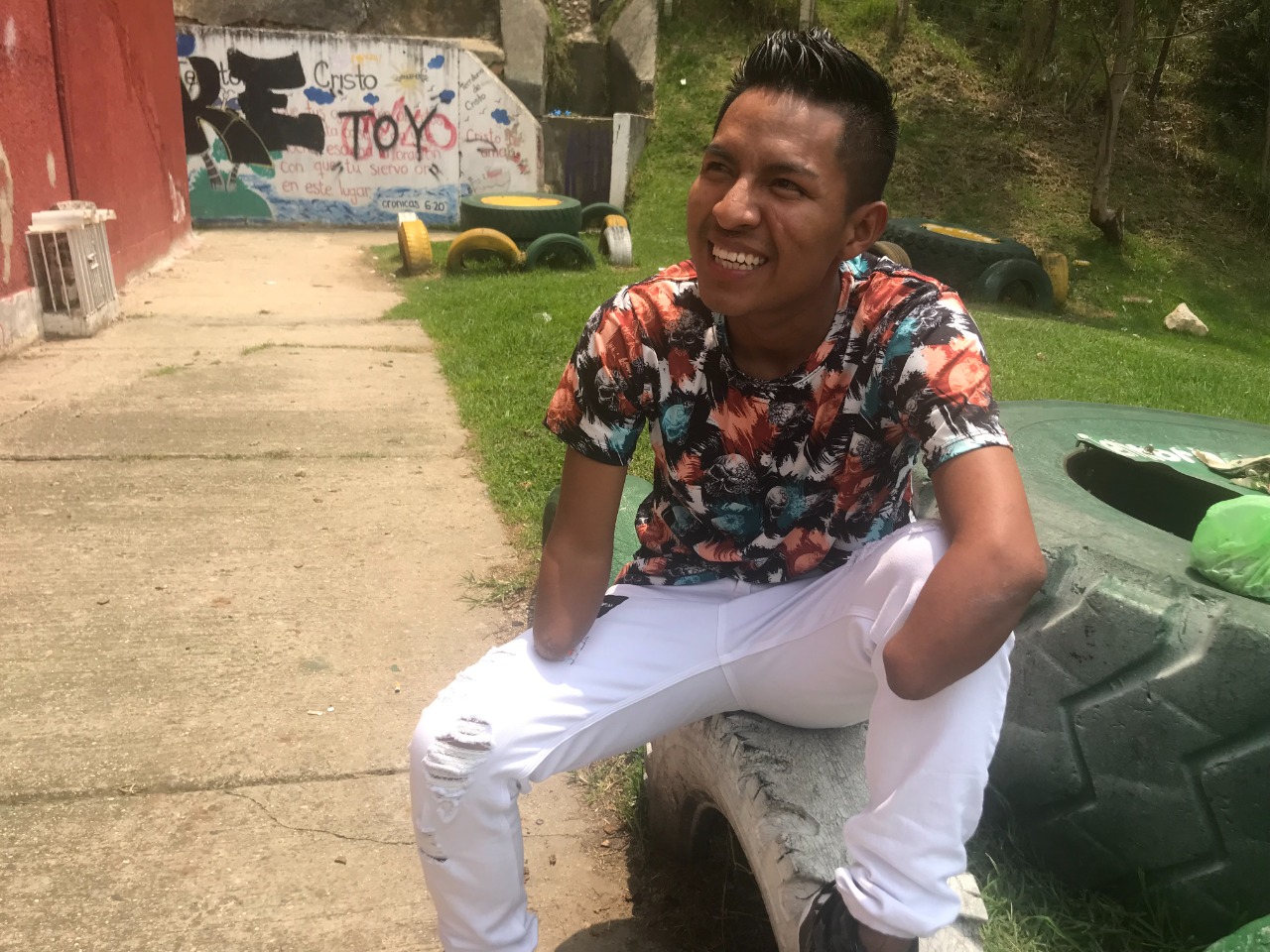 foto de sobreviviente a mina antipersona